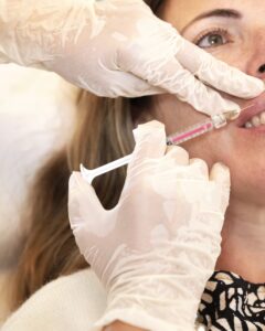 Practitioner injecting filler into the lips with a fine needle