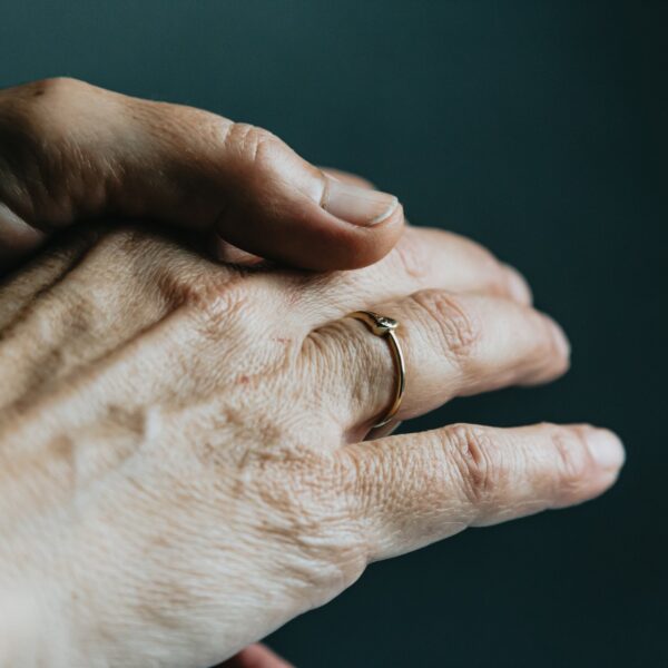 An adult hand wearing a gold ring, veins and tendons visible through the skin